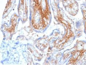 Immunohistochemical analysis of formalin-fixed, paraffin-embedded human placenta tissue using Anti-Decorin Antibody [DCN/6289] at 2µg/ml. Inset: PBS instead of the primary antibody. Secondary antibody negative control.