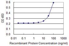 Anti-MNDA Mouse Monoclonal Antibody [clone: 1H2]