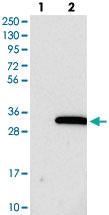 Anti-PIGX Rabbit Polyclonal Antibody