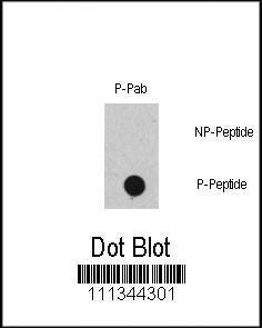 Anti-RAF1 Rabbit Polyclonal Antibody (APC (Allophycocyanin))