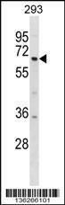 Anti-DYRK1B Rabbit Polyclonal Antibody (HRP (Horseradish Peroxidase))