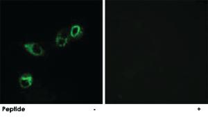 Anti-ACKR4 Rabbit Polyclonal Antibody