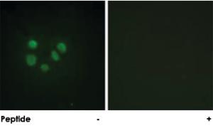 Anti-BLM Rabbit Polyclonal Antibody