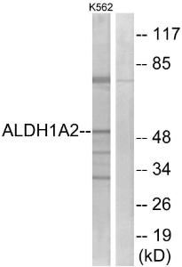 Anti-ALDH1A2 Rabbit Polyclonal Antibody