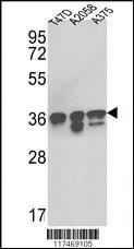 Anti-NPM1 Rabbit Polyclonal Antibody