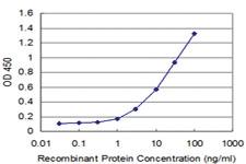 Anti-FOSL2 Mouse Monoclonal Antibody [clone: 4F5-1B10]