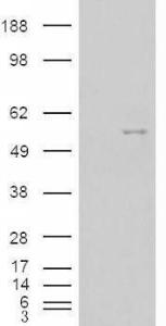 HEK293 overexpressing NOVA1 (RC210407) and probed with Anti-NOVA1 Antibody (A83421) (mock transfection in first lane), tested by Origene