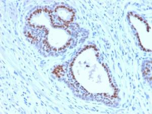 Immunohistochemical analysis of formalin-fixed, paraffin-embedded human tonsil using Anti-FOXA1 Antibody [FOXA1/2230R]