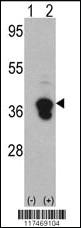 Anti-NPM1 Rabbit Polyclonal Antibody