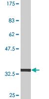 Anti-VDAC1 Mouse Monoclonal Antibody [clone: 2A8]