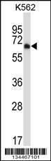 Anti-DYRK2 Rabbit Polyclonal Antibody (AP (Alkaline Phosphatase))