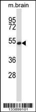 Anti-GTF2H1 Rabbit Polyclonal Antibody (AP (Alkaline Phosphatase))