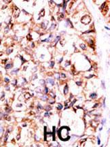 Anti-TFPI2 Rabbit Polyclonal Antibody (AP (Alkaline Phosphatase))