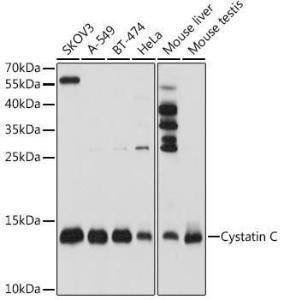 Antibody anti-CST3 100 µl