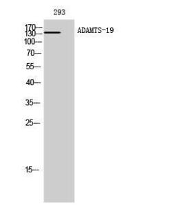 Western blot analysis of 293 cells using Anti-ADAMTS19 Antibody