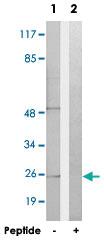 Anti-CD302 Rabbit Polyclonal Antibody