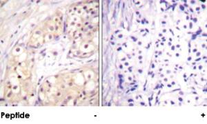 Anti-BRAF Rabbit Polyclonal Antibody