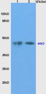 Anti-SHBG Rabbit Polyclonal Antibody