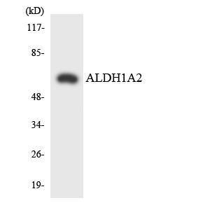 Antibody anti-ALDH1A2 A96603-100 100 µg