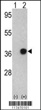 Anti-NPM1 Rabbit Polyclonal Antibody