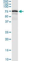 Anti-CENPB Polyclonal Antibody Pair