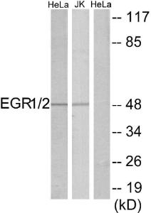 Antibody anti-EGR1 EGR2 A95534-100 100 µg