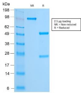 SDS-PAGE analysis of Anti-FOXA1 Antibody [FOXA1/2230R] under non-reduced and reduced conditions; showing intact IgG and intact heavy and light chains, respectively. SDS-PAGE analysis confirms the integrity and purity of the antibody