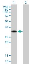 Anti-ZBTB32 Mouse Polyclonal Antibody