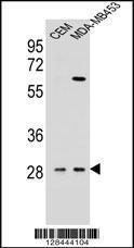 Anti-IL12B Rabbit Polyclonal Antibody (HRP (Horseradish Peroxidase))