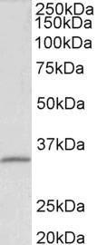 Anti-FBL Antibody (A85056) (0.1 µg/ml) staining of HEK293 lysate (35 µg protein in RIPA buffer). Primary incubation was 1 hour. Detected by chemiluminescence