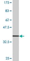 Anti-SLC11A2 Mouse Monoclonal Antibody [clone: 4G2]