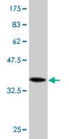 Anti-CCDC6 Mouse Monoclonal Antibody [clone: 5D11]