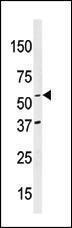 Anti-NAE1 Rabbit Polyclonal Antibody (APC (Allophycocyanin))