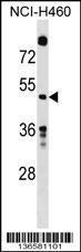 Anti-GDA Rabbit Polyclonal Antibody (FITC (Fluorescein Isothiocyanate))