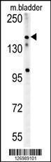 Anti-CASZ1 Rabbit Polyclonal Antibody (FITC (Fluorescein Isothiocyanate))