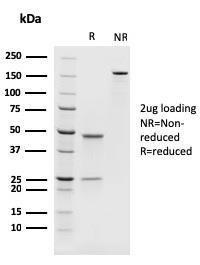 Anti-PAX8 Mouse Recombinant Antibody [clone: rPAX8/1492]