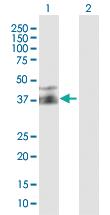 Anti-FPR2 Mouse Polyclonal Antibody