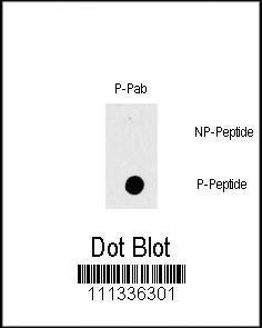 Anti-RAF1 Rabbit Polyclonal Antibody (HRP (Horseradish Peroxidase))