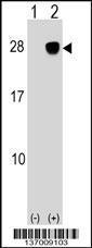 Anti-ULBP2 Rabbit Polyclonal Antibody