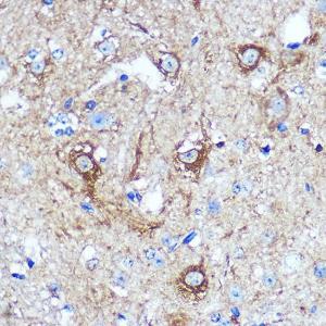 Immunohistochemistry analysis of paraffin-embedded mouse spinal cord using Anti-KIBRA Antibody (A93147) at a dilution of 1:100 (40x lens). Perform microwave antigen retrieval with 10 mM PBS buffer pH 7.2 before commencing with IHC staining protocol.