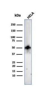 Western blot analysis of HeLa cell lysate using Anti-FOXA1 Antibody [FOXA1/2230R]