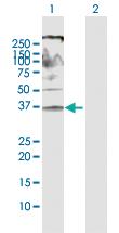 Anti-FPR2 Rabbit Polyclonal Antibody