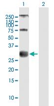 Anti-MOG Mouse Polyclonal Antibody