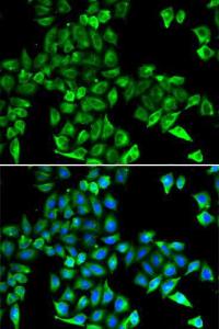 Antibody anti-CST3 100 µl