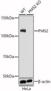 Antibody A305289-100 100 µl