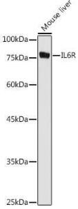 Western blot analysis of extracts of Mouse liver, using Anti-IL-6R Antibody (A8941) at 1:1000 dilution