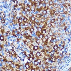 Immunohistochemistry analysis of paraffin-embedded rat ovary using Anti-KIBRA Antibody (A93147) at a dilution of 1:100 (40x lens). Perform microwave antigen retrieval with 10 mM PBS buffer pH 7.2 before commencing with IHC staining protocol.