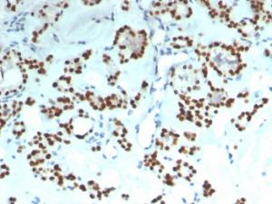 Anti-PAX8 Mouse Recombinant Antibody [clone: rPAX8/1492]