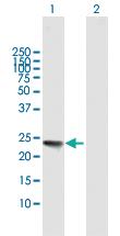 Anti-IL32 Mouse Polyclonal Antibody