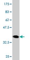 Anti-VDAC1 Mouse Monoclonal Antibody [clone: 2A8]